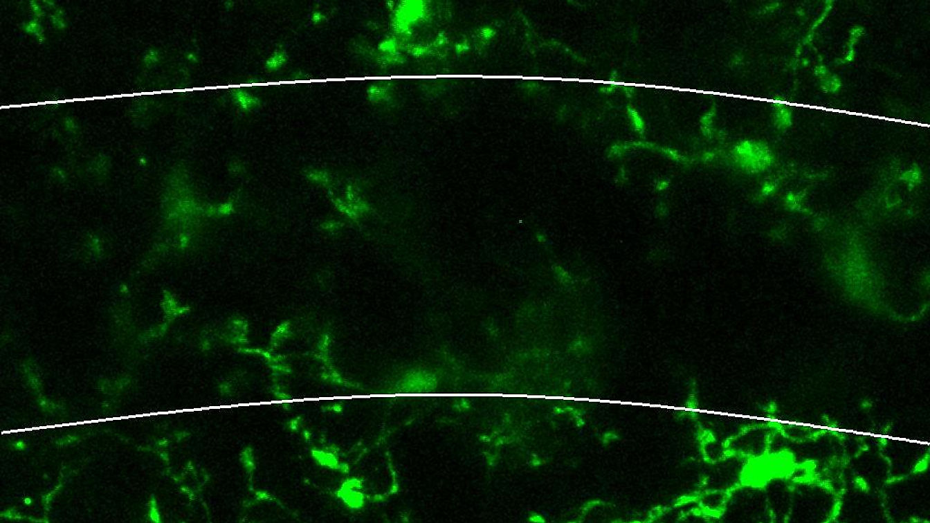 Microglia Respond by Extending Their Processes Towards Neurons in Hippocampal Brain Slice with Glutamate Treatment